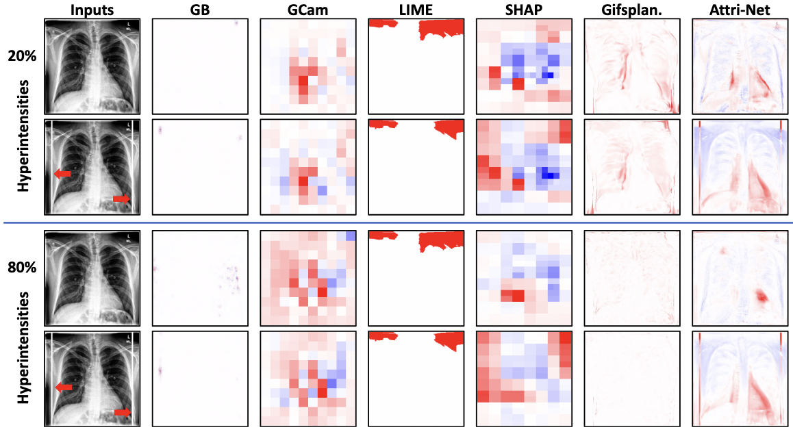 Right for the Wrong Reason: Can Interpretable ML Techniques Detect Spurious Correlations?